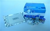 巨噬细胞刺激蛋白检测试剂盒,MSP试剂盒