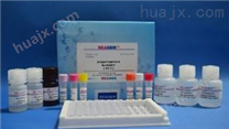 类白细胞抗原B27检测试剂盒,HLA-B27试剂盒