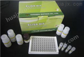 聚集蛋白检测试剂盒,Agrin试剂盒